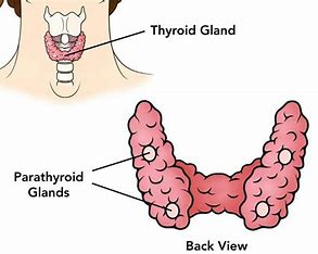 اختلالات پاراتیروئید